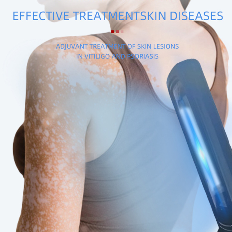 Candle Making Supplies Uk - UVB Lamp for Therapy Psoriasis Lamp