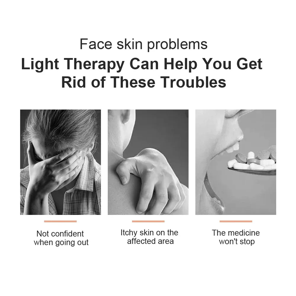 UVB Lamp for Therapy Psoriasis - Candle Making Supplies Uk บทวิจารณ์และราคา